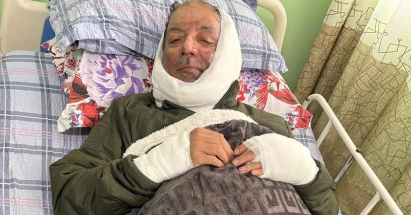 बेलुन पड्केर जलेका पोखराका मेयर आचार्य अस्पतालबाट डिस्चार्ज